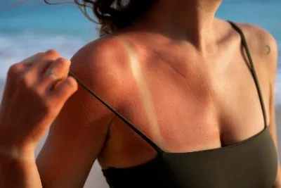 Comment protéger sa peau du soleil ?